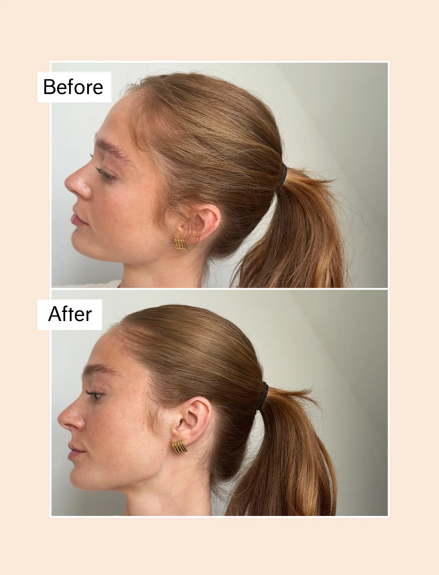 Flyaway fix - Image 5